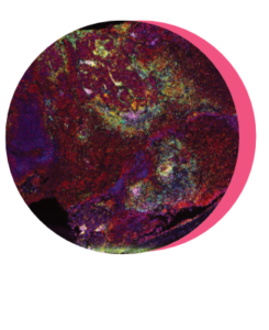 lung slice