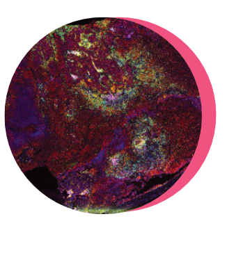 lung slice