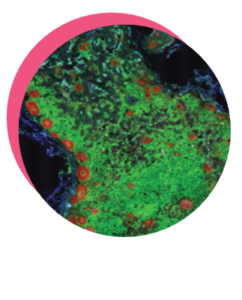 lymph node slice