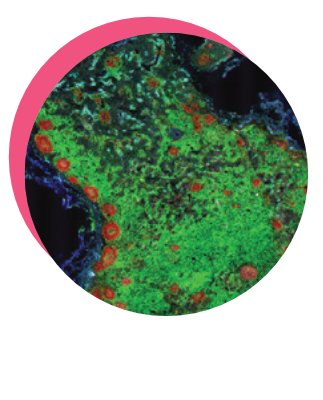 lymph node slice