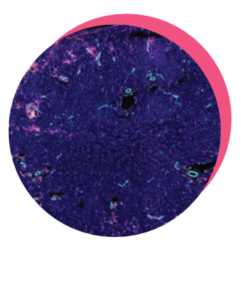 skin slice