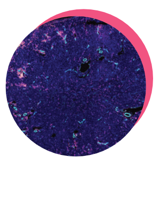 skin slice