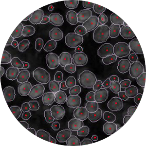 Cellular segmentation and Quality control