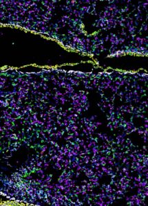zeiss Mouse Lung Imaged With 37 antibody codex panel inset e1628108012163 864x1536 1 576x1024 1